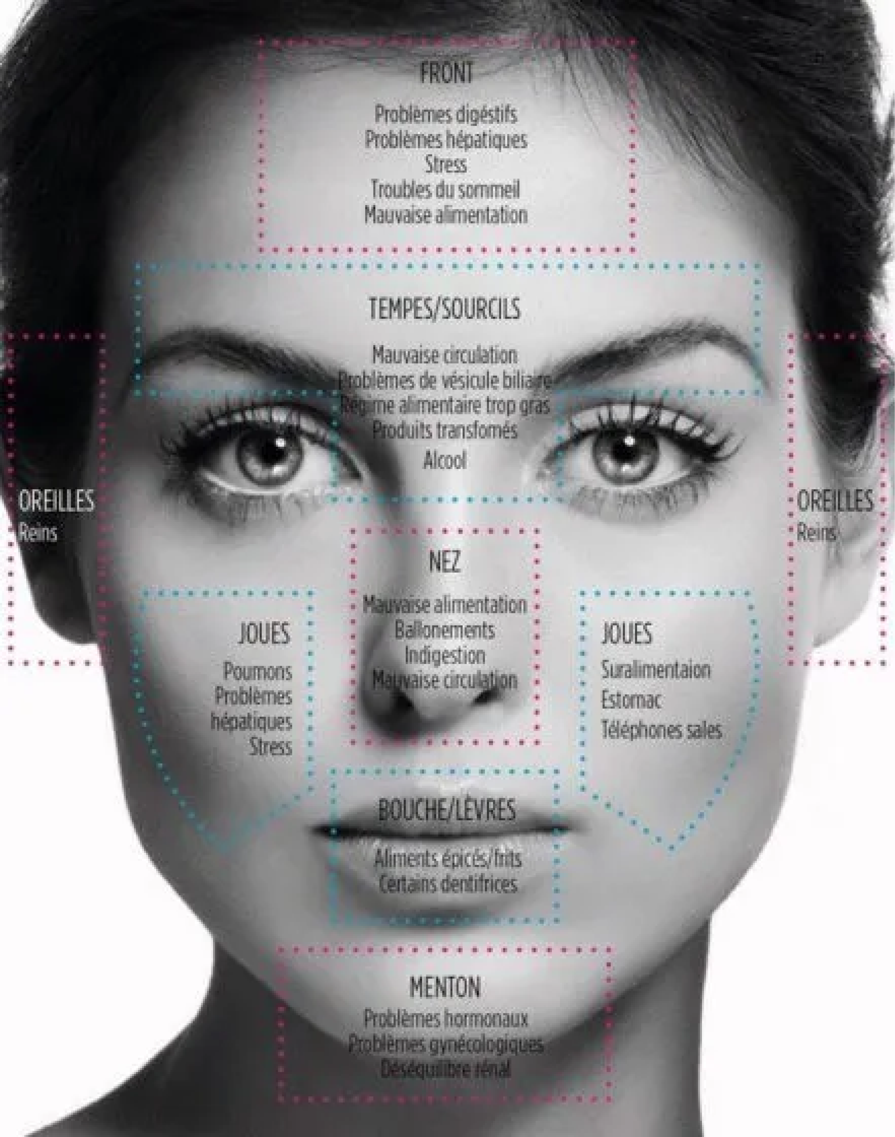 acn&eacute;-imperfections-boutons